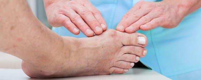 Physiotherapie Bei Einem Hallux Valgus