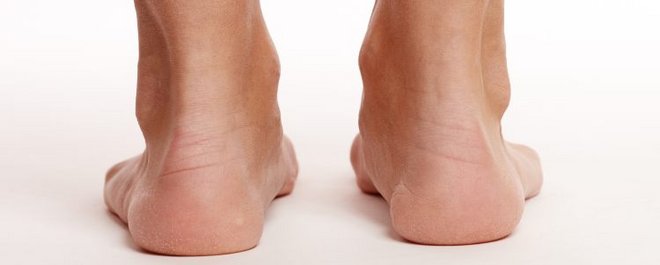 Physiotherapie Achillodynie
