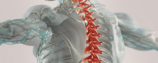 Die Spondylarthritis befällt hauptsächlich die Facettengelenke