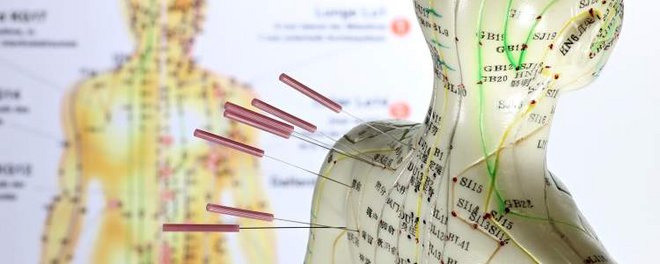 Angewandte Alternativmedizin Die Akupunktur ist eine mögliche angewandte Methode aus der Alternativmedizin