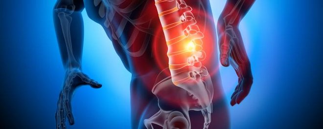 Physiotherapie bei Erkrankungen an der LWS