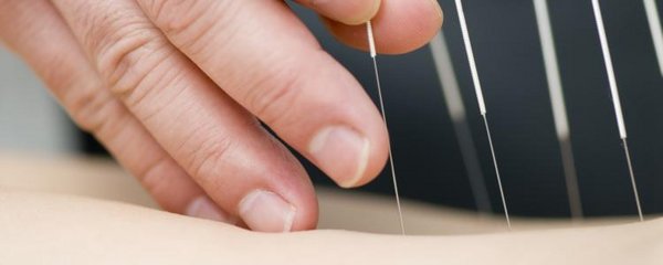 Traditionelle chinesische Medizin Akupunktur