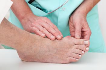 Physiotherapie bei Erkrankungen am Vorfuß Behandlung des Hallux valgus